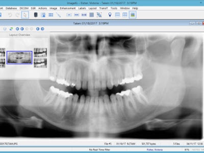 kodak dental imaging software download